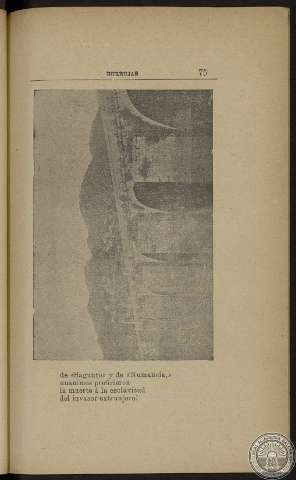 75