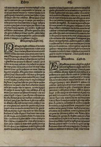 148