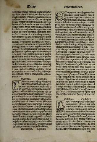 151